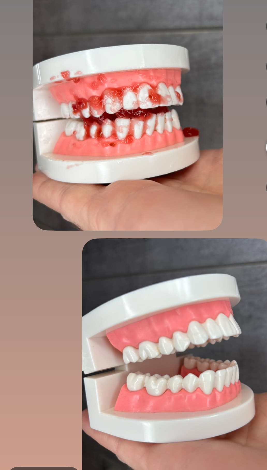 Inteligentny Przenośny Irygator Dentystyczny z 4 Dyszami, 3 Trybami i Akumulatorem 🦷