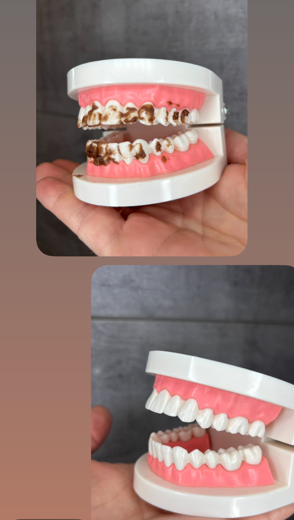 Inteligentny Przenośny Irygator Dentystyczny z 4 Dyszami, 3 Trybami i Akumulatorem 🦷
